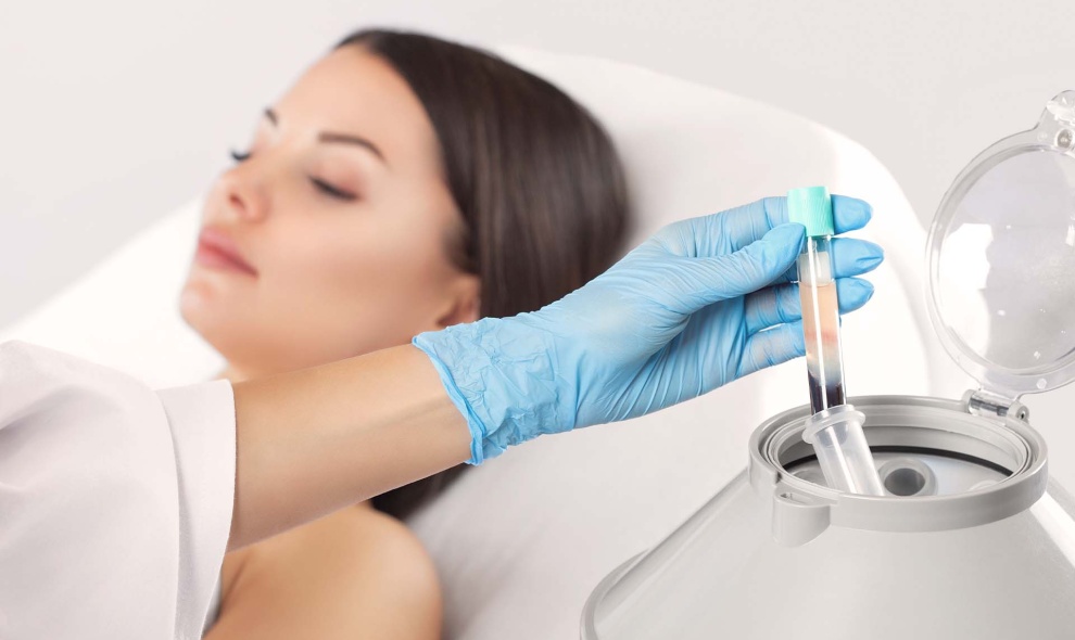 PRP hair plasma therapy